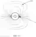 Fig. 12 - Method and apparatus for rapid and selective transurethral tissue ablation