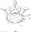 Fig. 04 - System and method for detecting application of grounding pad for ablation devices