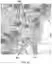 Fig. 10 - Method and apparatus for selective treatment of biological tissue