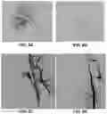 Fig. 13 - HYDROGEL CO-INJECTION AND REAL-TIME OPTO-ELECTROMAGNETIC MODIFICATION DEVICE FOR TUNABLE IN-VIVO DELIVERY