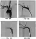 Fig. 15 - HYDROGEL CO-INJECTION AND REAL-TIME OPTO-ELECTROMAGNETIC MODIFICATION DEVICE FOR TUNABLE IN-VIVO DELIVERY