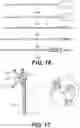 Fig. 12 - Robot surgical platform