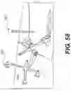 Fig. 31 - Robot surgical platform