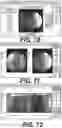 Fig. 37 - Robot surgical platform
