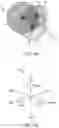 Fig. 05 - ELECTROMAGNETIC SENSING FOR USE WITH ABLATION TREATMENT