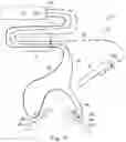 Fig. 11 - Shape sensor systems with redundant sensing