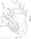 Fig. 14 - Suspension system for remote catheter guidance
