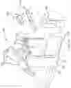 Fig. 15 - Suspension system for remote catheter guidance