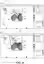 Fig. 13 - Robotic surgical system with recovery alignment