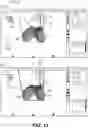 Fig. 14 - Robotic surgical system with recovery alignment