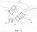 Fig. 08 - Zygomatic Dental Implant Guide and Method of Use
