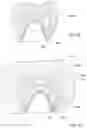 Fig. 10 - SYSTEM AND METHOD FOR MANUFACTURING A DENTAL PROSTHESIS AND A DENTAL PROSTHESIS MANUFACTURED THEREBY