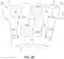Fig. 04 - Dental appliances and associated systems and methods