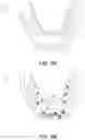 Fig. 08 - Dental appliances and associated systems and methods