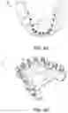 Fig. 09 - Dental appliances and associated systems and methods