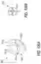 Fig. 102 - Dental appliances and associated systems and methods