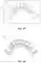 Fig. 11 - Dental appliances and associated systems and methods