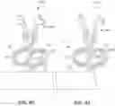 Fig. 34 - Dental appliances and associated systems and methods