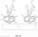 Fig. 35 - Dental appliances and associated systems and methods