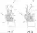 Fig. 38 - Dental appliances and associated systems and methods