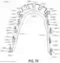 Fig. 53 - Dental appliances and associated systems and methods