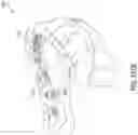 Fig. 87 - Dental appliances and associated systems and methods