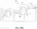 Fig. 91 - Dental appliances and associated systems and methods