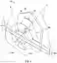 Fig. 05 - Orthodontic Brackets