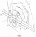 Fig. 06 - Orthodontic Brackets