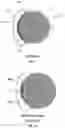 Fig. 09 - Zygomatic implant with partially interrupted threaded portion