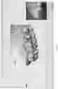Fig. 16 - SCANNER DEVICE WITH REPLACEABLE SCANNING-TIPS