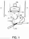 Fig. 02 - SYSTEMS AND METHODS TO REDUCE SPATTER AND AEROSOL DURING DENTAL PROCEDURES