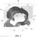 Fig. 04 - SYSTEMS AND METHODS TO REDUCE SPATTER AND AEROSOL DURING DENTAL PROCEDURES