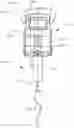 Fig. 04 - SYSTEM FOR INFORMATIONAL MAGNETIC FEEDBACK IN ADJUSTABLE IMPLANTS
