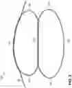 Fig. 03 - URETHRAL IMPLANT