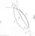 Fig. 04 - URETHRAL IMPLANT