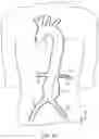 Fig. 08 - MODULAR BRANCHED ENDOPROSTHETIC SYSTEMS, DEVICES, AND METHODS