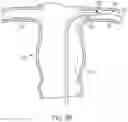 Fig. 09 - MODULAR BRANCHED ENDOPROSTHETIC SYSTEMS, DEVICES, AND METHODS