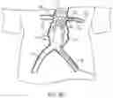 Fig. 11 - MODULAR BRANCHED ENDOPROSTHETIC SYSTEMS, DEVICES, AND METHODS