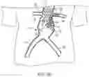 Fig. 12 - MODULAR BRANCHED ENDOPROSTHETIC SYSTEMS, DEVICES, AND METHODS