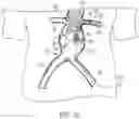 Fig. 15 - MODULAR BRANCHED ENDOPROSTHETIC SYSTEMS, DEVICES, AND METHODS