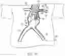 Fig. 16 - MODULAR BRANCHED ENDOPROSTHETIC SYSTEMS, DEVICES, AND METHODS