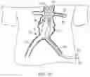 Fig. 19 - MODULAR BRANCHED ENDOPROSTHETIC SYSTEMS, DEVICES, AND METHODS