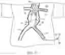 Fig. 20 - MODULAR BRANCHED ENDOPROSTHETIC SYSTEMS, DEVICES, AND METHODS