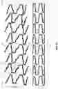 Fig. 04 - STENTS WITH INCREASED FLEXIBILITY