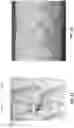 Fig. 14 - STENTS WITH INCREASED FLEXIBILITY