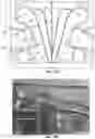 Fig. 18 - STENTS WITH INCREASED FLEXIBILITY