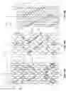 Fig. 21 - STENTS WITH INCREASED FLEXIBILITY