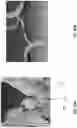 Fig. 26 - STENTS WITH INCREASED FLEXIBILITY