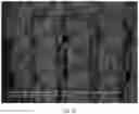 Fig. 08 - Composite scaffold for the repair, reconstruction, and regeneration of soft tissues